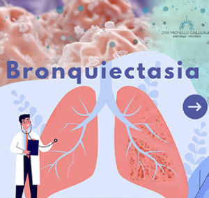 Bronquiectasia